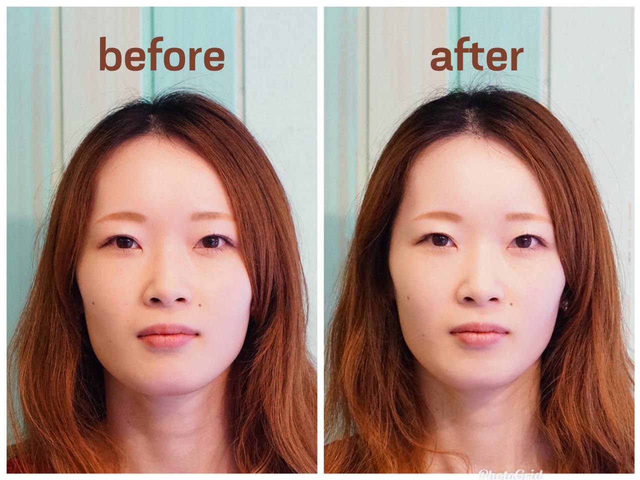 短時間なのに小顔になりました!